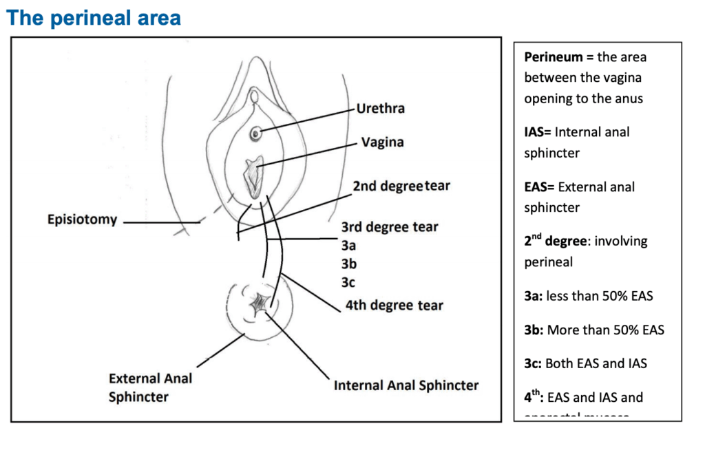 how to look after your episiotomy or tear