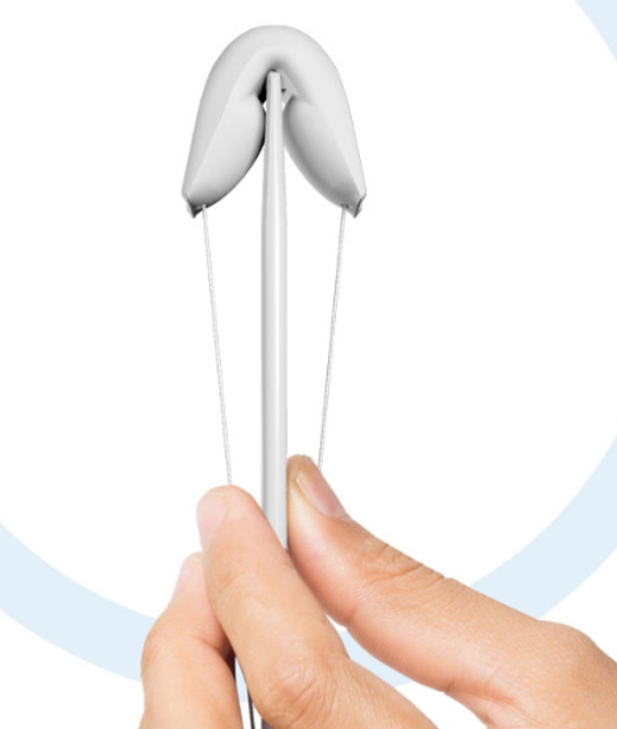 Contrelle activgard is a bladder support pessary